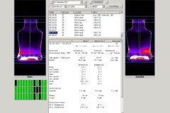 Figure 4: Poor quality bottles with ‘stuck bottom’ defects