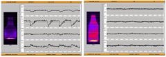 Figure 6: Intensity control chart, (left) bad swabbing, (right) optimised swabbing